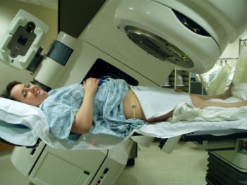 радиотерапия при раке шейки матки в Израиле